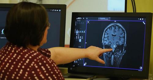 Meredith Reid points to an image of a brain scan at Auburn University's Neuroimaging Center.